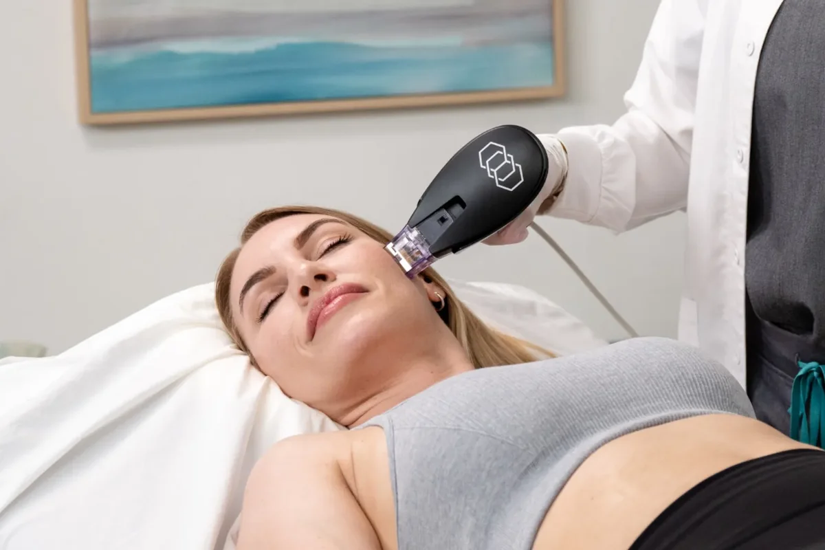 Morpheus8 RF microneedling device
